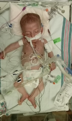 Baby in a hospital bed