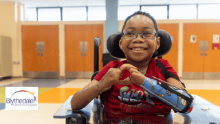 photo of child in a wheelchair with a prosthetic