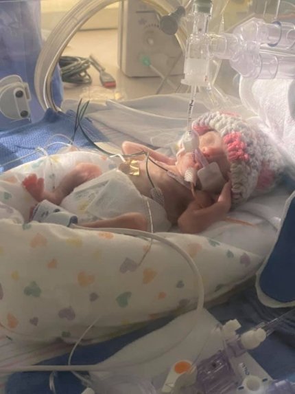 baby just born