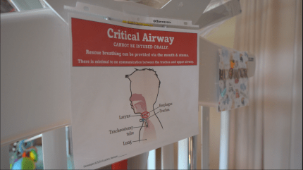 Critical Airway sign that describes to EMS workers how to help a child